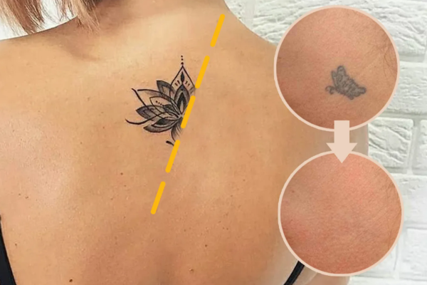 Risultati del fondotinta (NTM) CoverPlus