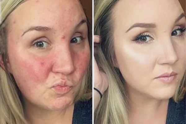 Ingredienti del fondotinta (NTM) CoverPlus